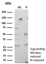 TIGIT/VSTM3/VSIG9 (Immune Checkpoint for Cancer) Antibody in SDS-PAGE (SDS-PAGE)