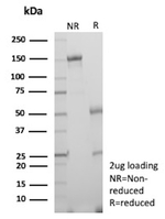 TIGIT/VSTM3/VSIG9 (Immune Checkpoint for Cancer) Antibody in SDS-PAGE (SDS-PAGE)