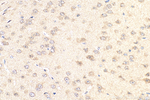 PDZD4 Antibody in Immunohistochemistry (Paraffin) (IHC (P))