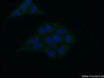 BRP16 Antibody in Immunocytochemistry (ICC/IF)