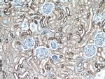 KGA Antibody in Immunohistochemistry (Paraffin) (IHC (P))
