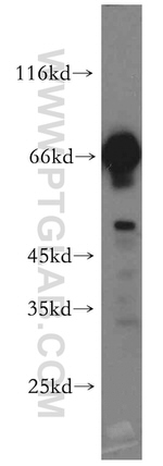 KGA Antibody in Western Blot (WB)