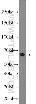 KGA Antibody in Western Blot (WB)