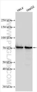 GLS2 Antibody in Western Blot (WB)
