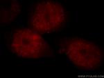 NCOA5 Antibody in Immunocytochemistry (ICC/IF)
