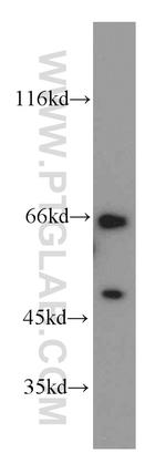 NCOA5 Antibody in Western Blot (WB)