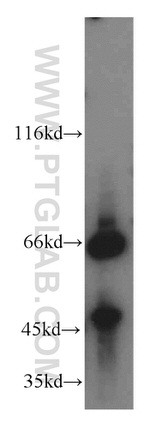 NCOA5 Antibody in Western Blot (WB)