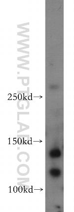 Trappc9/NIBP Antibody in Western Blot (WB)