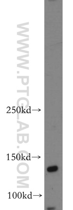 Trappc9/NIBP Antibody in Western Blot (WB)