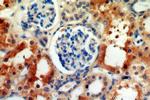 PSAT1 Antibody in Immunohistochemistry (Paraffin) (IHC (P))