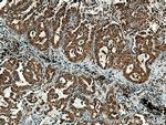 PSAT1 Antibody in Immunohistochemistry (Paraffin) (IHC (P))