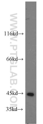 PSAT1 Antibody in Western Blot (WB)