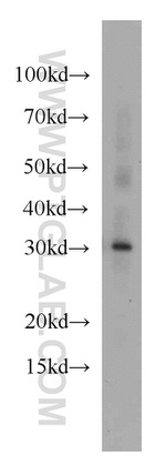 MRTO4 Antibody in Western Blot (WB)