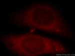C11orf49 Antibody in Immunocytochemistry (ICC/IF)