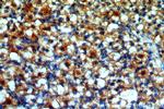 POTEA Antibody in Immunohistochemistry (Paraffin) (IHC (P))