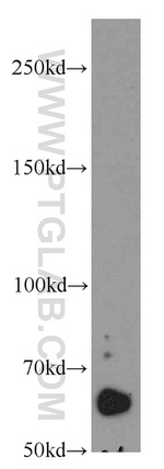 POTED Antibody in Western Blot (WB)