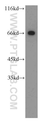 POTED Antibody in Western Blot (WB)