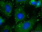 RFPL4B Antibody in Immunocytochemistry (ICC/IF)