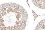 RFPL4B Antibody in Immunohistochemistry (Paraffin) (IHC (P))