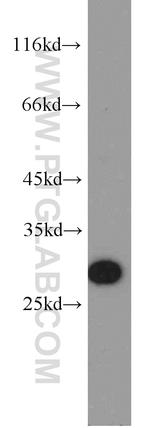 NARFL Antibody in Western Blot (WB)