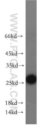 NARFL Antibody in Western Blot (WB)