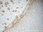 EPHA6 Antibody in Immunohistochemistry (Paraffin) (IHC (P))