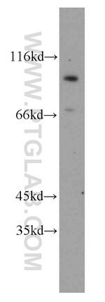 GPRIN3 Antibody in Western Blot (WB)