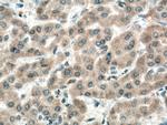 IGF1B Antibody in Immunohistochemistry (Paraffin) (IHC (P))