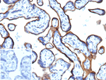 Endoglin/CD105 (Angiogenesis Marker) Antibody in Immunohistochemistry (Paraffin) (IHC (P))
