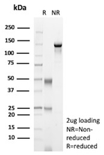 Endoglin/CD105 (Angiogenesis Marker) Antibody in SDS-PAGE (SDS-PAGE)