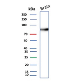 Endoglin/CD105 (Angiogenesis Marker) Antibody in Western Blot (WB)