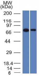 Endoglin/CD105 (Angiogenesis Marker) Antibody in Western Blot (WB)