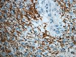 ROBO3 Antibody in Immunohistochemistry (Paraffin) (IHC (P))