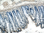 ARF6 Antibody in Immunohistochemistry (Paraffin) (IHC (P))