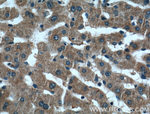 ARF1 Antibody in Immunohistochemistry (Paraffin) (IHC (P))