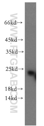 RAB5A Antibody in Western Blot (WB)