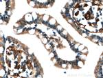 RAB11A Antibody in Immunohistochemistry (Paraffin) (IHC (P))