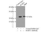 RAB11A Antibody in Immunoprecipitation (IP)