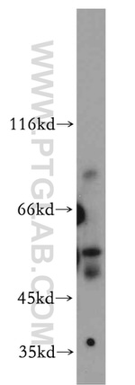 DLL1 Antibody in Western Blot (WB)