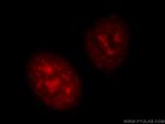 TOP2A Antibody in Immunocytochemistry (ICC/IF)