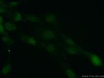 CSNK2B Antibody in Immunocytochemistry (ICC/IF)