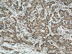 CSNK2B Antibody in Immunohistochemistry (Paraffin) (IHC (P))