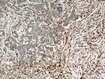 YES1 Antibody in Immunohistochemistry (Paraffin) (IHC (P))