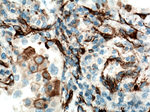YES1 Antibody in Immunohistochemistry (Paraffin) (IHC (P))