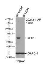 YES1 Antibody in Western Blot (WB)