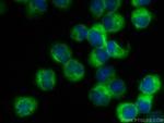 DOCK2 Antibody in Immunocytochemistry (ICC/IF)