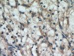 ROCK1 Antibody in Immunohistochemistry (Paraffin) (IHC (P))