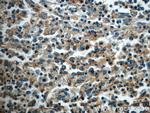 ROCK1 Antibody in Immunohistochemistry (Paraffin) (IHC (P))