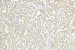 ROCK1 Antibody in Immunohistochemistry (Paraffin) (IHC (P))