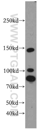 ROCK1 Antibody in Western Blot (WB)